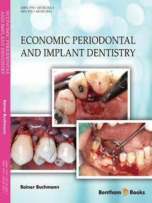 cover image of Economic Periodontal and Implant Dentistry